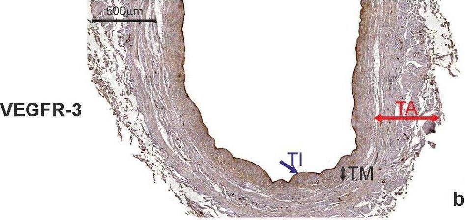 VEGFR3/Flt-4 Antibody (9D9) - Azide and BSA Free