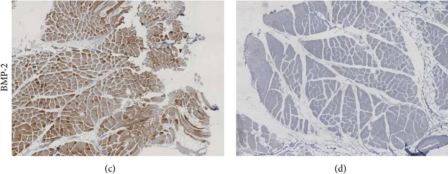 BMP-2 Antibody - BSA Free