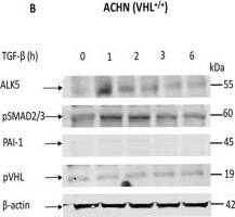 Serpin E1/PAI-1 Antibody - BSA Free