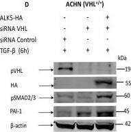 Serpin E1/PAI-1 Antibody - BSA Free