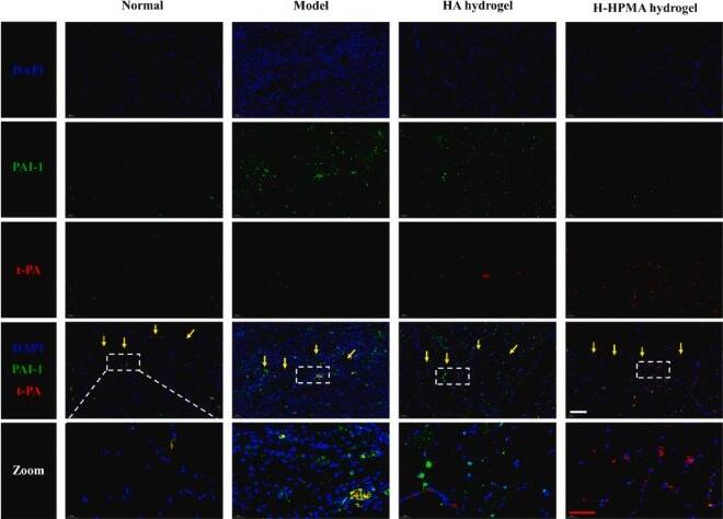 Serpin E1/PAI-1 Antibody - BSA Free