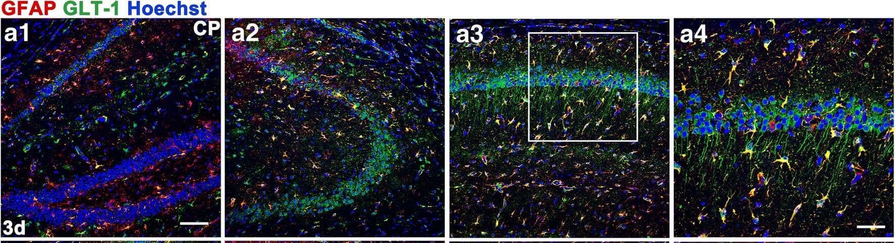 EAAT2/GLT1 Antibody