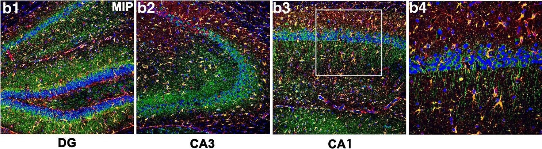 EAAT2/GLT1 Antibody