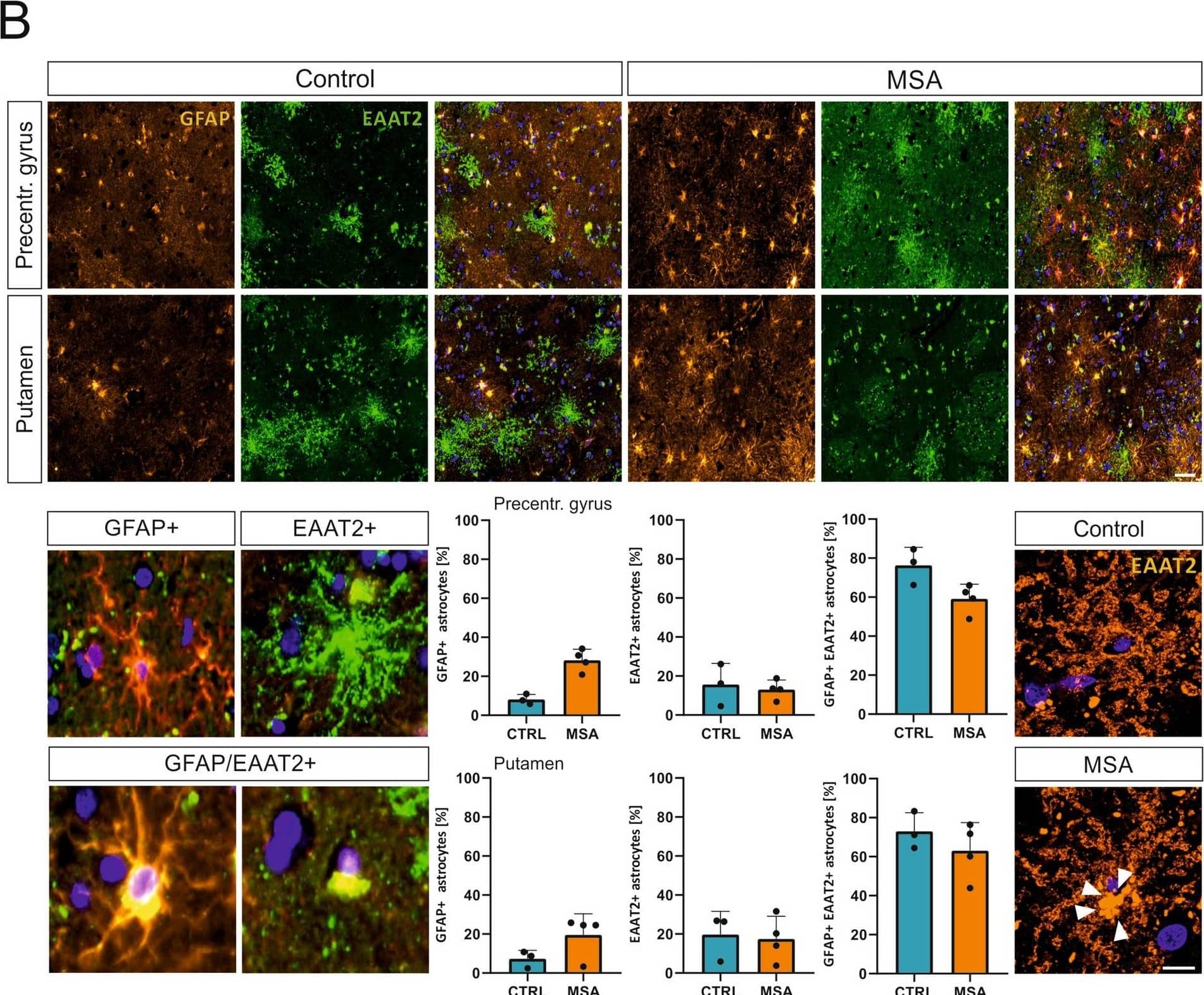EAAT2/GLT1 Antibody