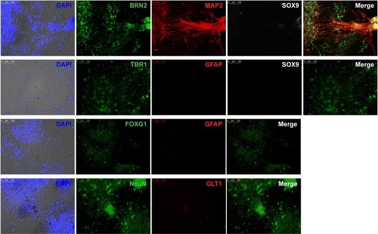 EAAT2/GLT1 Antibody