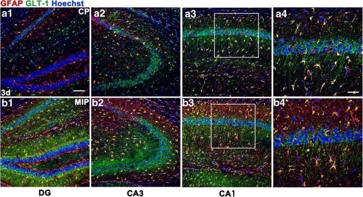 EAAT2/GLT1 Antibody