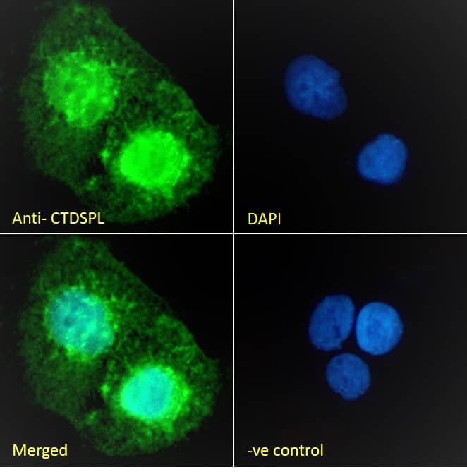 CTDSPL Antibody