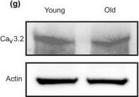 Cav3.2 Antibody (S55/10)