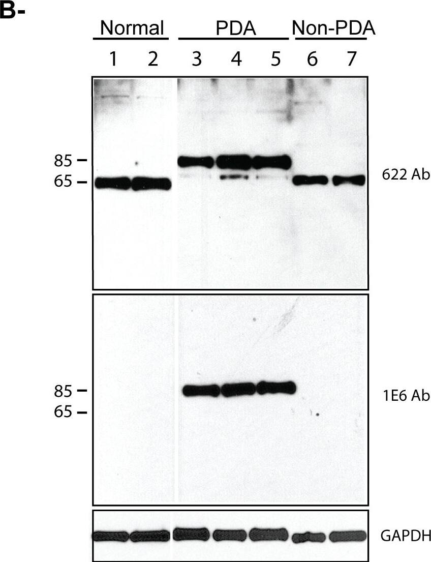 Palladin Antibody (1E6)