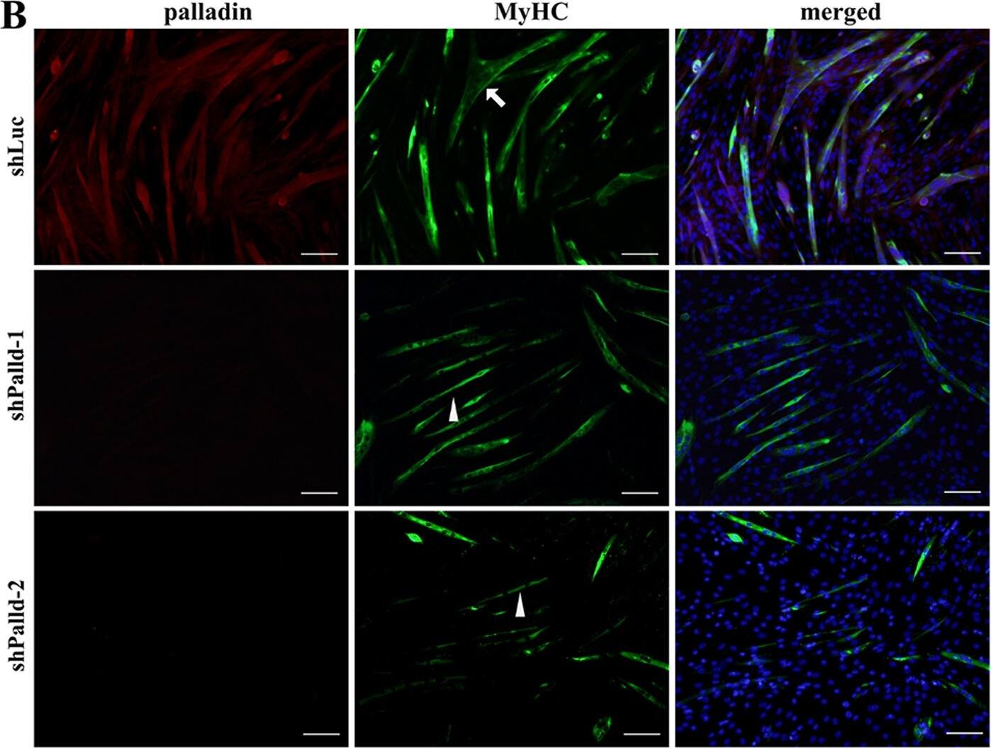 Palladin Antibody (1E6)