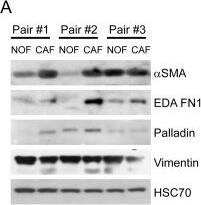 Palladin Antibody (1E6)