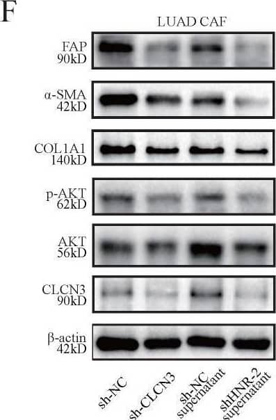 CLCN3 Antibody - BSA Free