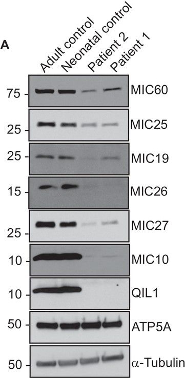 APOO Antibody (2F1)
