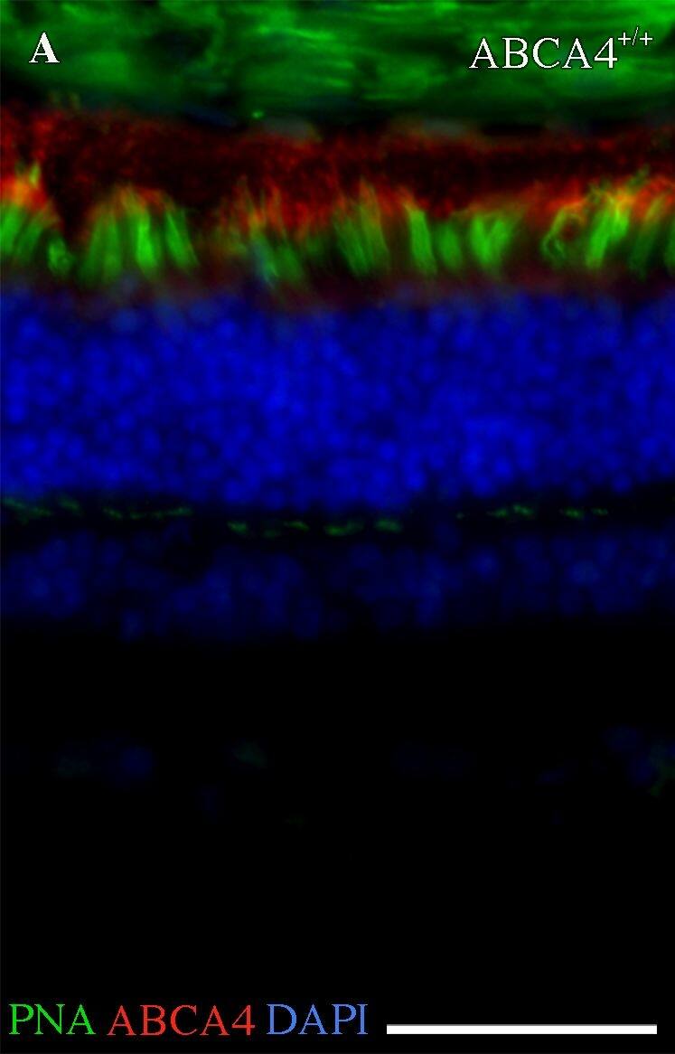 ABCA4 Antibody (3F4)