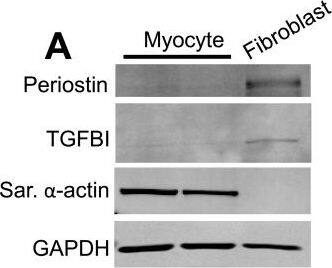 Periostin/OSF-2 Antibody - C-terminus - Azide and BSA Free