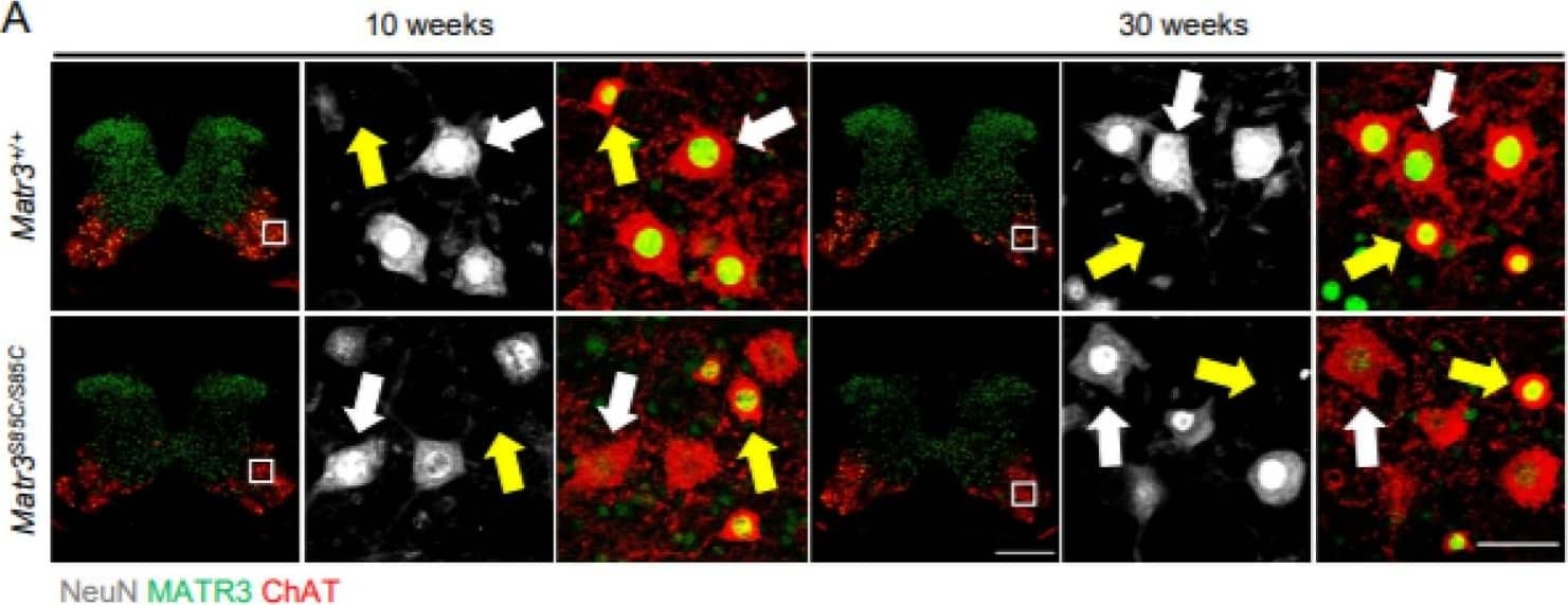 Choline Acetyltransferase/ChAT Antibody
