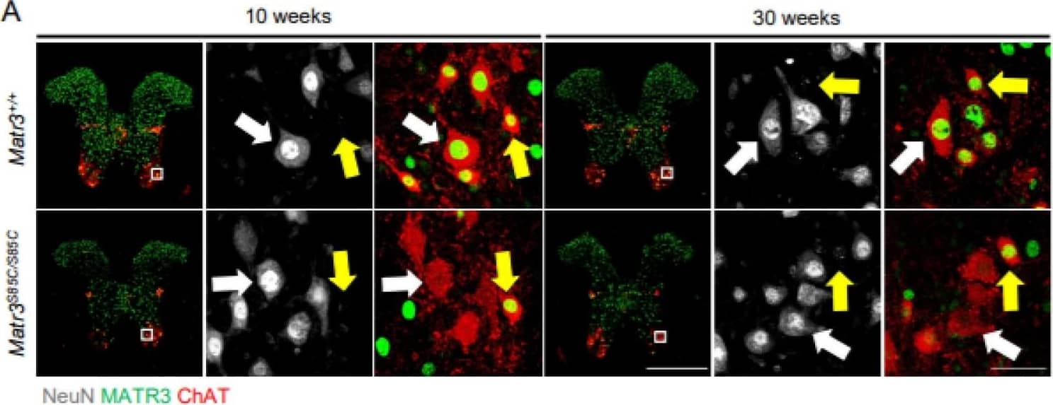 Choline Acetyltransferase/ChAT Antibody