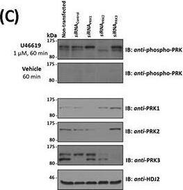 PKN3 Antibody