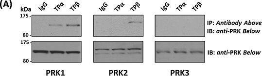 PKN3 Antibody