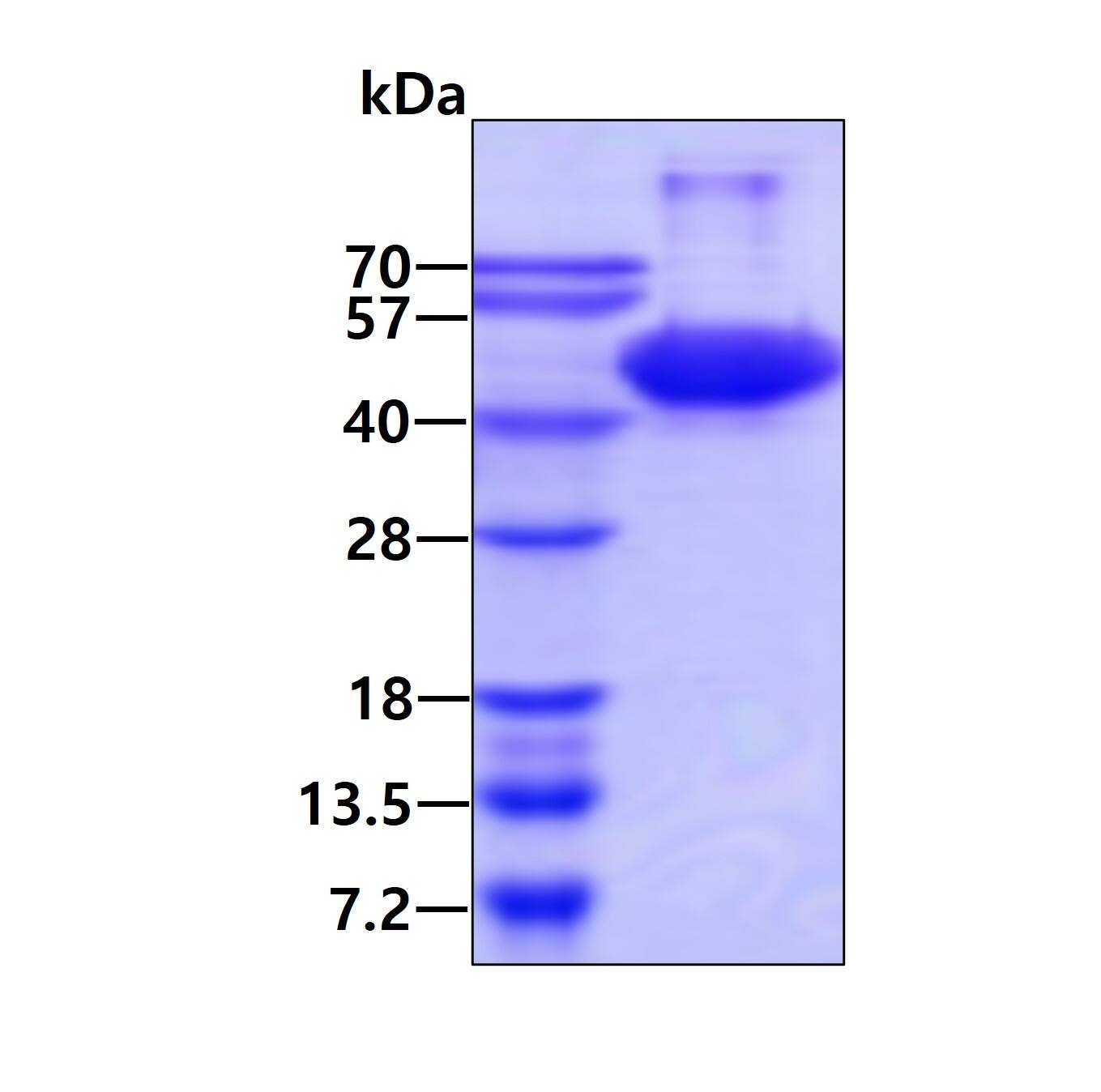 Recombinant Human Aurora B His Protein