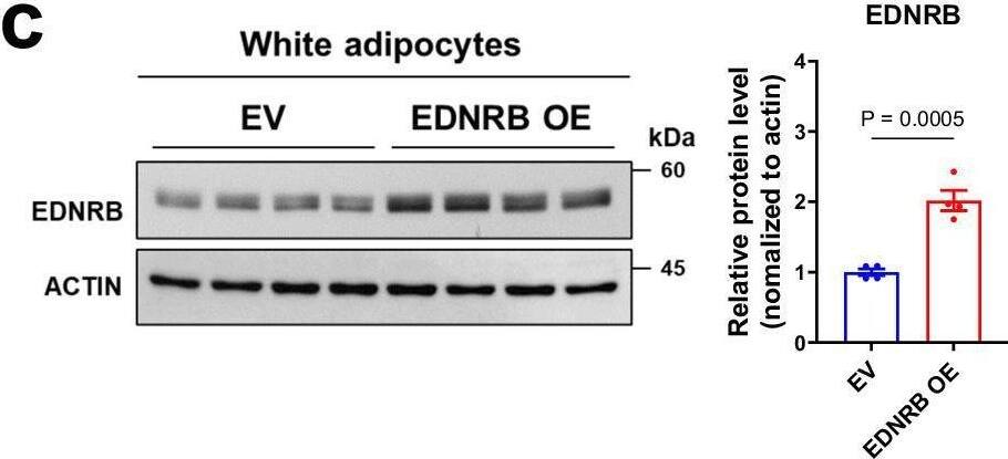 EDNRB/Endothelin R Type B Antibody - Azide and BSA Free
