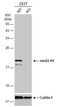 NM23-H1 Antibody