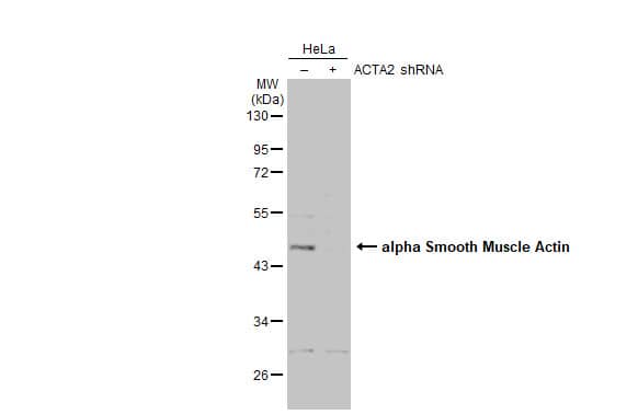alpha-Smooth Muscle Actin Antibody