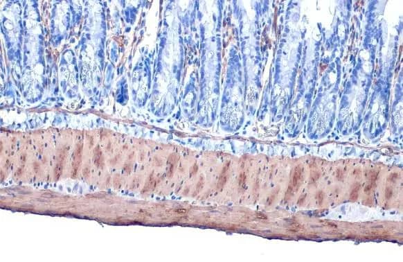 alpha-Smooth Muscle Actin Antibody