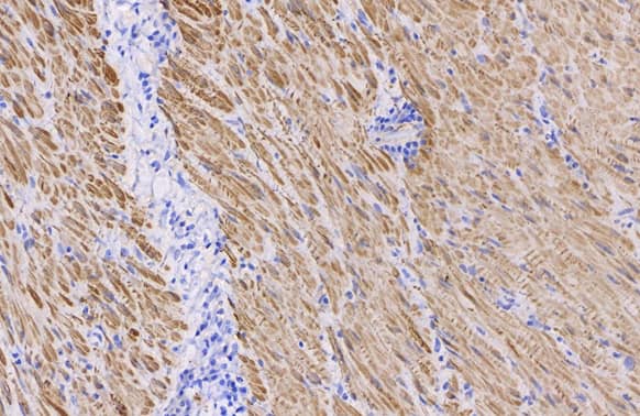 alpha-Smooth Muscle Actin Antibody