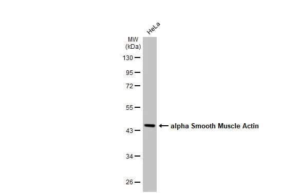 alpha-Smooth Muscle Actin Antibody