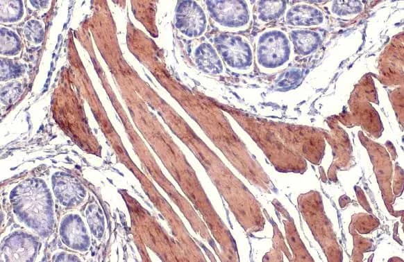 alpha-Smooth Muscle Actin Antibody