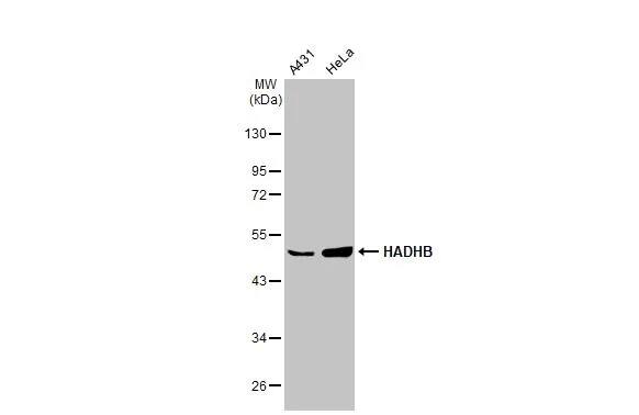 HADHB Antibody