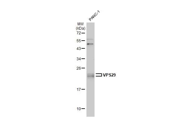 VPS29 Antibody