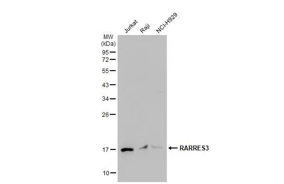 RARRES3 Antibody