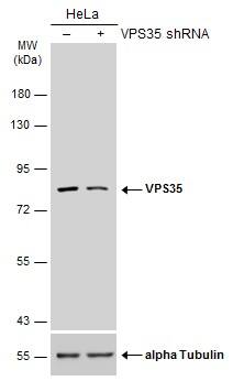 VPS35 Antibody