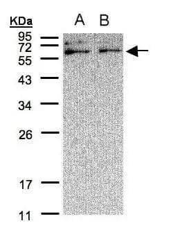 Xylulokinase/XYLB Antibody - BSA Free