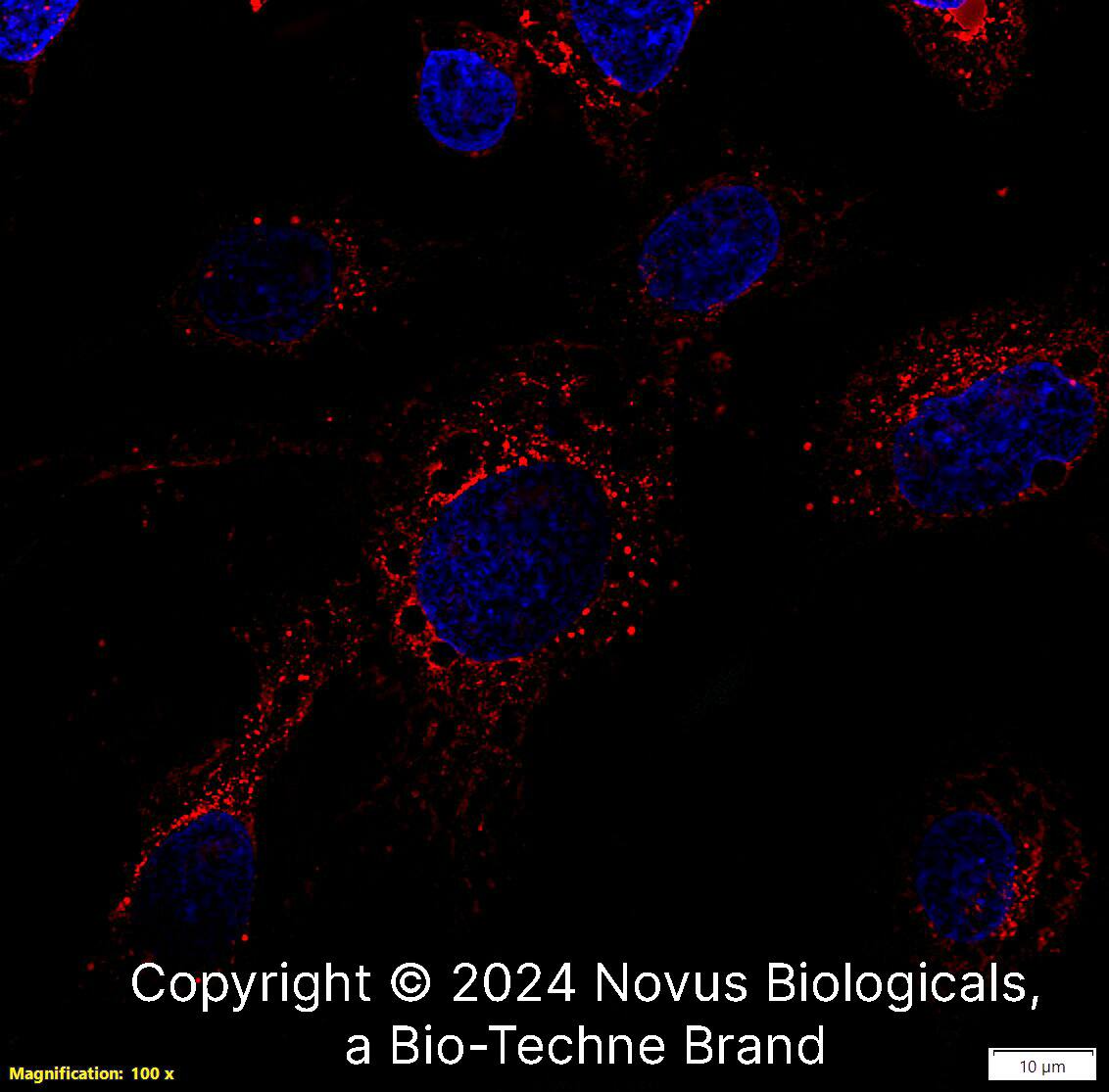 Apolipoprotein E/ApoE Antibody [Biotin]