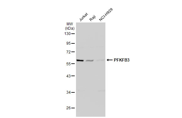 6 Phosphofructo 2 Kinase Antibody