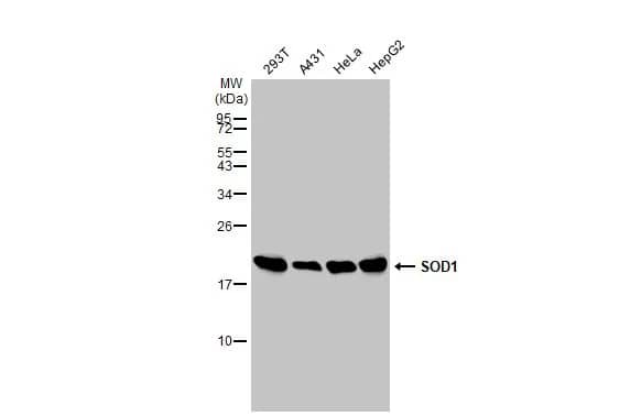 SOD1/Cu-Zn SOD Antibody