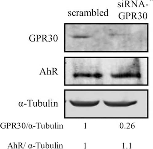 GPER/GPR30 Antibody