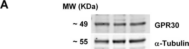 GPER/GPR30 Antibody