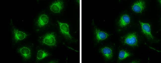 Dihydrolipoamide Dehydrogenase/DLD Antibody - BSA Free