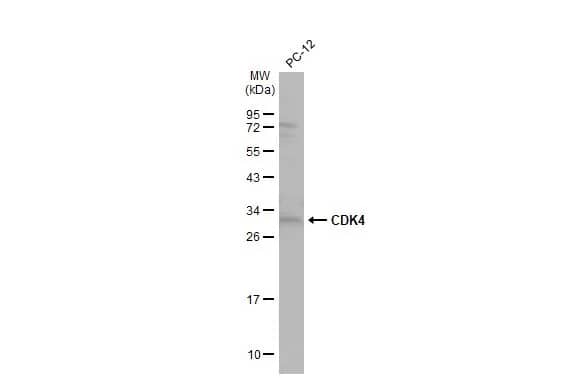 CDK4 Antibody