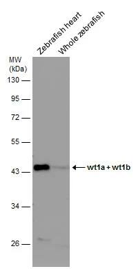 WT1 Antibody