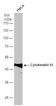 Cytokeratin 14 Antibody