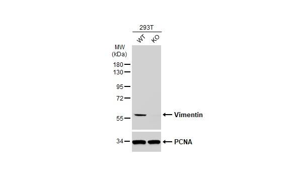 Vimentin Antibody