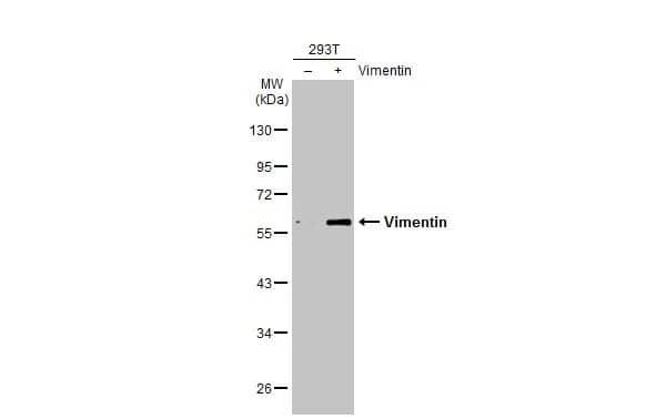 Vimentin Antibody