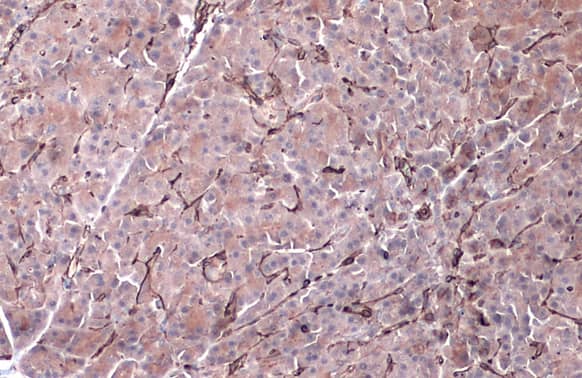 Vimentin Antibody