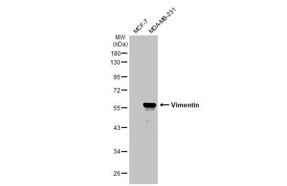 Vimentin Antibody