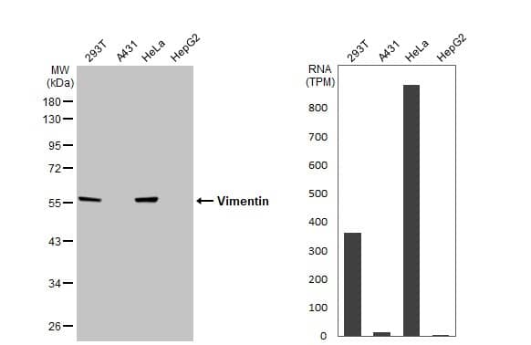 Vimentin Antibody